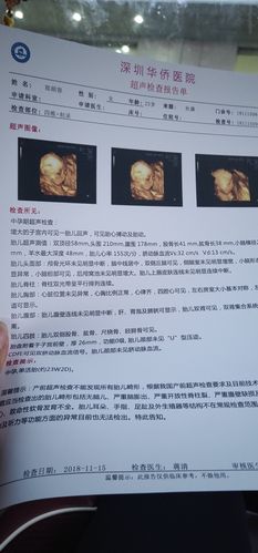 包生男孩成功率_包生男孩成功率大揭秘